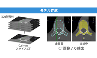 Simpleware SoftwareとLS-DYNAの連携による生体解析 - 胸腰椎