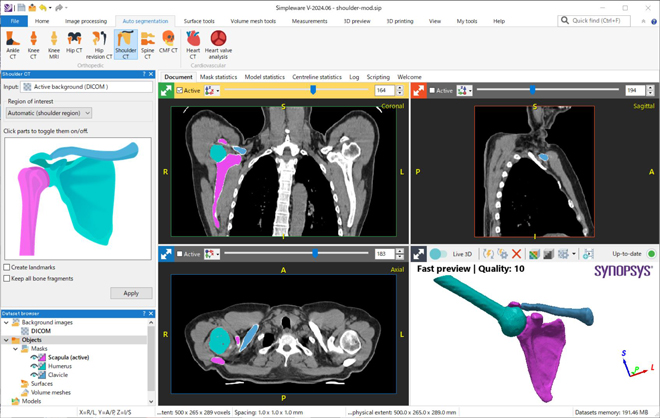 AS Ortho Module摜