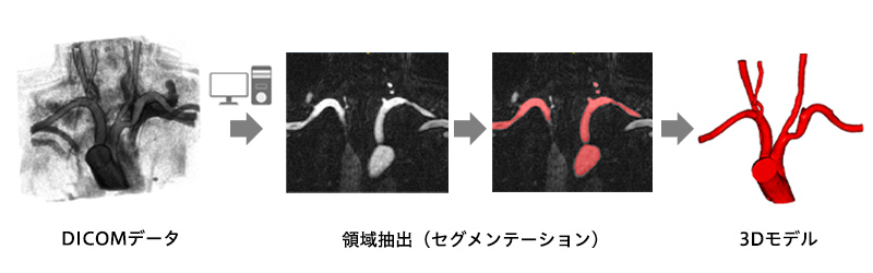 図1. DICOMデータから3Dモデルを作成する流れ