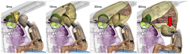図2. 初回計算結果のスクリーンショット。ダミー頭部の「押し下げ」が発生している。
