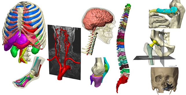 Simpleware Softwareによる人体モデリングの例