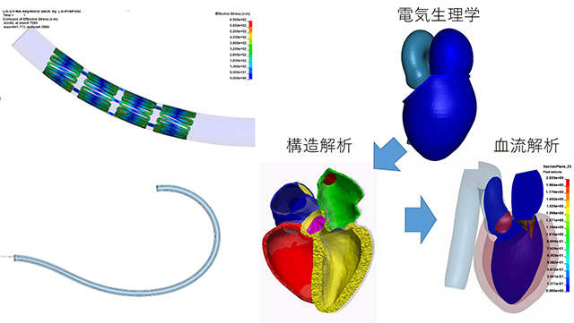 Ansys LS-DYNAによる医療系シミュレーションの例