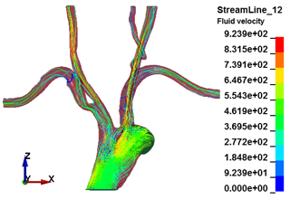 図10. ICFDによる血流解析