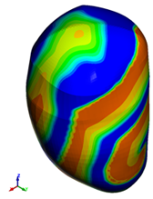 図9. 不整脈における心室の膜電位