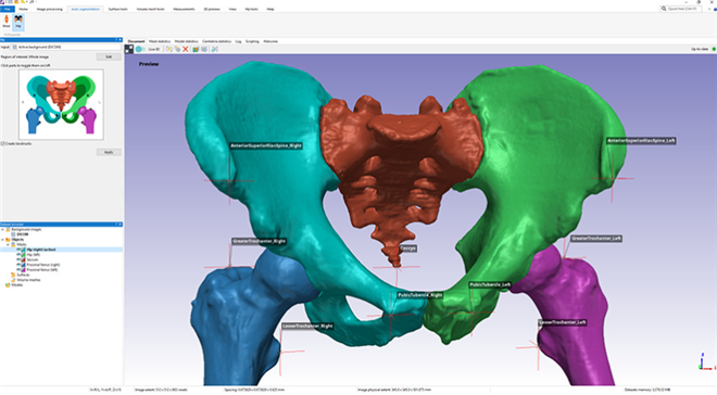 CT画像からの骨盤領域のモデル化