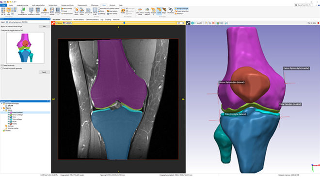 PD強調MRI画像からの膝のモデル化
