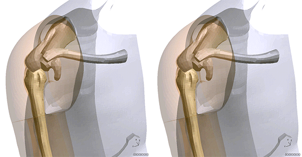 図3-2 ODYSSEEによる予測とLS-DYNAによる計算結果の比較